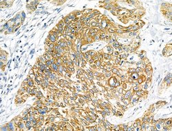 Invitrogen IL-20 Polyclonal Antibody 100 &mu;L; Unconjugated:Antibodies,