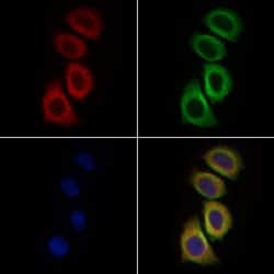 Invitrogen ERN1/ERN2 Polyclonal Antibody 100 &mu;L; Unconjugated:Antibodies,