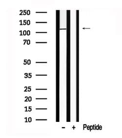 Invitrogen ERN1/ERN2 Polyclonal Antibody 100 &mu;L; Unconjugated:Antibodies,