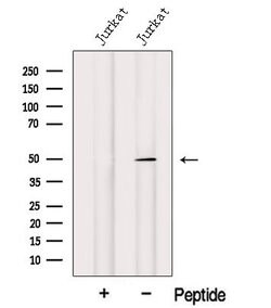Invitrogen IRF1 Polyclonal Antibody 100 &mu;L; Unconjugated:Antibodies,