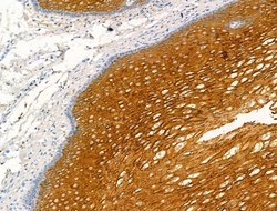 Invitrogen Kallikrein 9 Polyclonal Antibody 100 μL; Unconjugated:Antibodies,