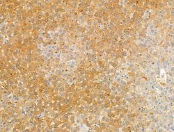 Invitrogen Kallikrein 9 Polyclonal Antibody 100 μL; Unconjugated:Antibodies,