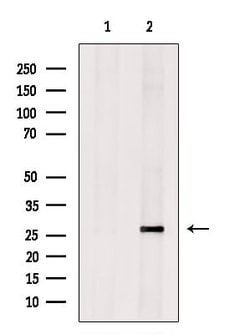 Invitrogen Kallikrein 9 Polyclonal Antibody 100 μL; Unconjugated:Antibodies,