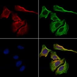 Invitrogen Kappa Light Chain Polyclonal Antibody 100 &mu;L | Buy Online | Invitrogen&trade; | Fisher Scientific