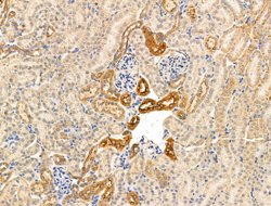 Invitrogen Kappa Light Chain Polyclonal Antibody 100 &mu;L | Buy Online | Invitrogen&trade; | Fisher Scientific