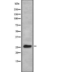 Invitrogen KCNIP1 Polyclonal Antibody 100 &mu;L | Buy Online | Invitrogen&trade; | Fisher Scientific