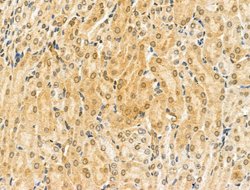 Invitrogen KVbeta2 (KCNAB2) Polyclonal Antibody 100 &mu;L; Unconjugated:Antibodies,