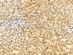 Invitrogen KVbeta2 (KCNAB2) Polyclonal Antibody 100 &mu;L; Unconjugated:Antibodies,