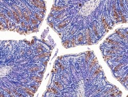 Invitrogen KCNK10 Polyclonal Antibody 100 &mu;L; Unconjugated:Antibodies,