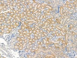 Invitrogen KCNK2 Polyclonal Antibody 100 &mu;L; Unconjugated:Antibodies,