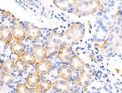 Invitrogen KCNK5 Polyclonal Antibody 100 &mu;L; Unconjugated:Antibodies,
