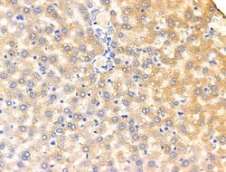 Invitrogen KCNK5 Polyclonal Antibody 100 &mu;L; Unconjugated:Antibodies,