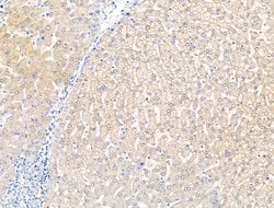 Invitrogen KCNK5 Polyclonal Antibody 100 &mu;L; Unconjugated:Antibodies,