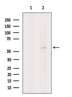 Invitrogen KCNK5 Polyclonal Antibody 100 &mu;L; Unconjugated:Antibodies,