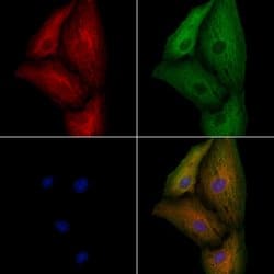 Invitrogen KCNK9 Polyclonal Antibody 100 &mu;L; Unconjugated:Antibodies,
