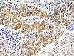 Invitrogen KCNK9 Polyclonal Antibody 100 &mu;L; Unconjugated:Antibodies,