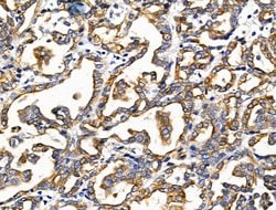 Invitrogen KCNK9 Polyclonal Antibody 100 &mu;L; Unconjugated:Antibodies,