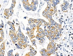 Invitrogen KCNK9 Polyclonal Antibody 100 &mu;L; Unconjugated:Antibodies,