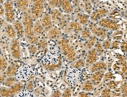 Invitrogen KCNN3 Polyclonal Antibody 100 &mu;L; Unconjugated:Antibodies,