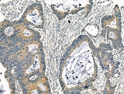 Invitrogen KCNN3 Polyclonal Antibody 100 &mu;L; Unconjugated:Antibodies,