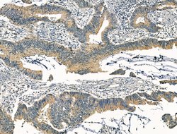 Invitrogen KCNN3 Polyclonal Antibody 100 &mu;L; Unconjugated:Antibodies,