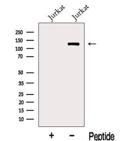 Invitrogen KDM2A Polyclonal Antibody 100 &mu;L; Unconjugated:Antibodies,