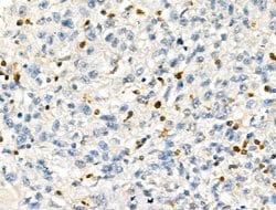 JMJD2A Polyclonal Antibody:Antibodies, Polyclonal