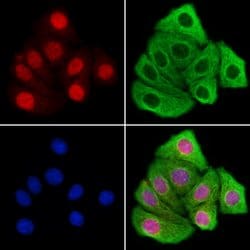 JMJD2B Polyclonal Antibody:Antibodies, Polyclonal