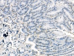 JMJD2B Polyclonal Antibody:Antibodies, Polyclonal