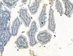 JMJD2B Polyclonal Antibody:Antibodies, Polyclonal