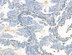 JMJD2B Polyclonal Antibody:Antibodies, Polyclonal