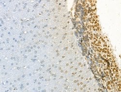 JMJD2B Polyclonal Antibody:Antibodies, Polyclonal