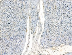 JMJD2B Polyclonal Antibody:Antibodies, Polyclonal