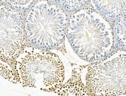 JMJD2B Polyclonal Antibody:Antibodies, Polyclonal