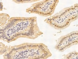 Invitrogen JARID1C Polyclonal Antibody 100 &mu;L; Unconjugated:Antibodies,