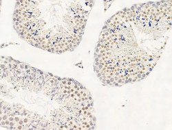 Invitrogen JARID1C Polyclonal Antibody 100 &mu;L; Unconjugated:Antibodies,