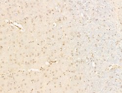 Invitrogen JARID1C Polyclonal Antibody 100 &mu;L; Unconjugated:Antibodies,