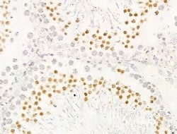 Invitrogen JARID1C Polyclonal Antibody 100 &mu;L; Unconjugated:Antibodies,