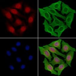 Invitrogen KDM6A Polyclonal Antibody 100 &mu;L; Unconjugated:Antibodies,