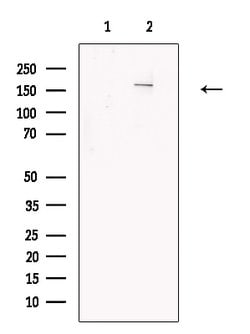 Invitrogen KDM6A Polyclonal Antibody 100 &mu;L; Unconjugated:Antibodies,
