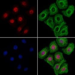 KIF17 Polyclonal Antibody 100 &mu;L | Buy Online | Thermo Scientific | Fisher Scientific