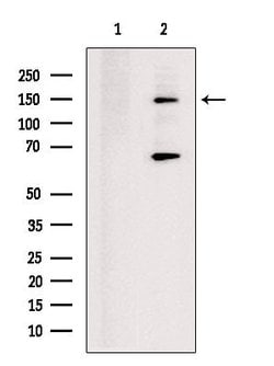 KIF17 Polyclonal Antibody 100 &mu;L | Buy Online | Thermo Scientific | Fisher Scientific