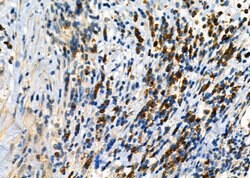 Invitrogen KIF4A Polyclonal Antibody 100 &mu;L; Unconjugated:Antibodies,
