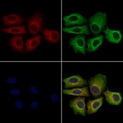 Invitrogen KIR2DL4 Polyclonal Antibody 100 &mu;L; Unconjugated:Antibodies,