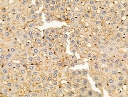 Invitrogen KIR2DL4 Polyclonal Antibody 100 &mu;L; Unconjugated:Antibodies,
