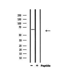Invitrogen Epstein Barr Virus Polyclonal Antibody 100 &mu;L | Buy Online | Invitrogen&trade; | Fisher Scientific