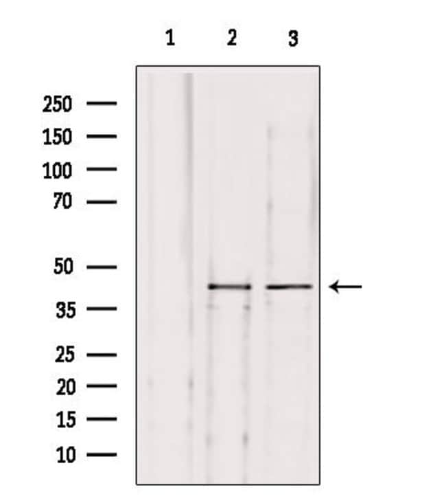 Herpes Simplex Virus Type 1 (strain SC16) Polyclonal Antibody