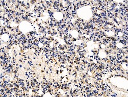 KLF15 Polyclonal Antibody, Invitrogen 100 &mu;L; Unconjugated:Antibodies,