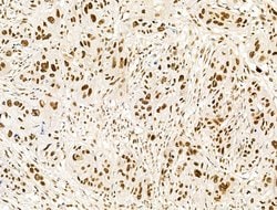 Invitrogen KLF2 Polyclonal Antibody 100 &mu;L; Unconjugated:Antibodies,