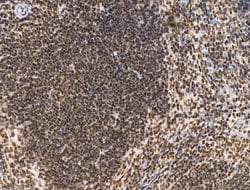 Invitrogen KLF2 Polyclonal Antibody 100 &mu;L; Unconjugated:Antibodies,